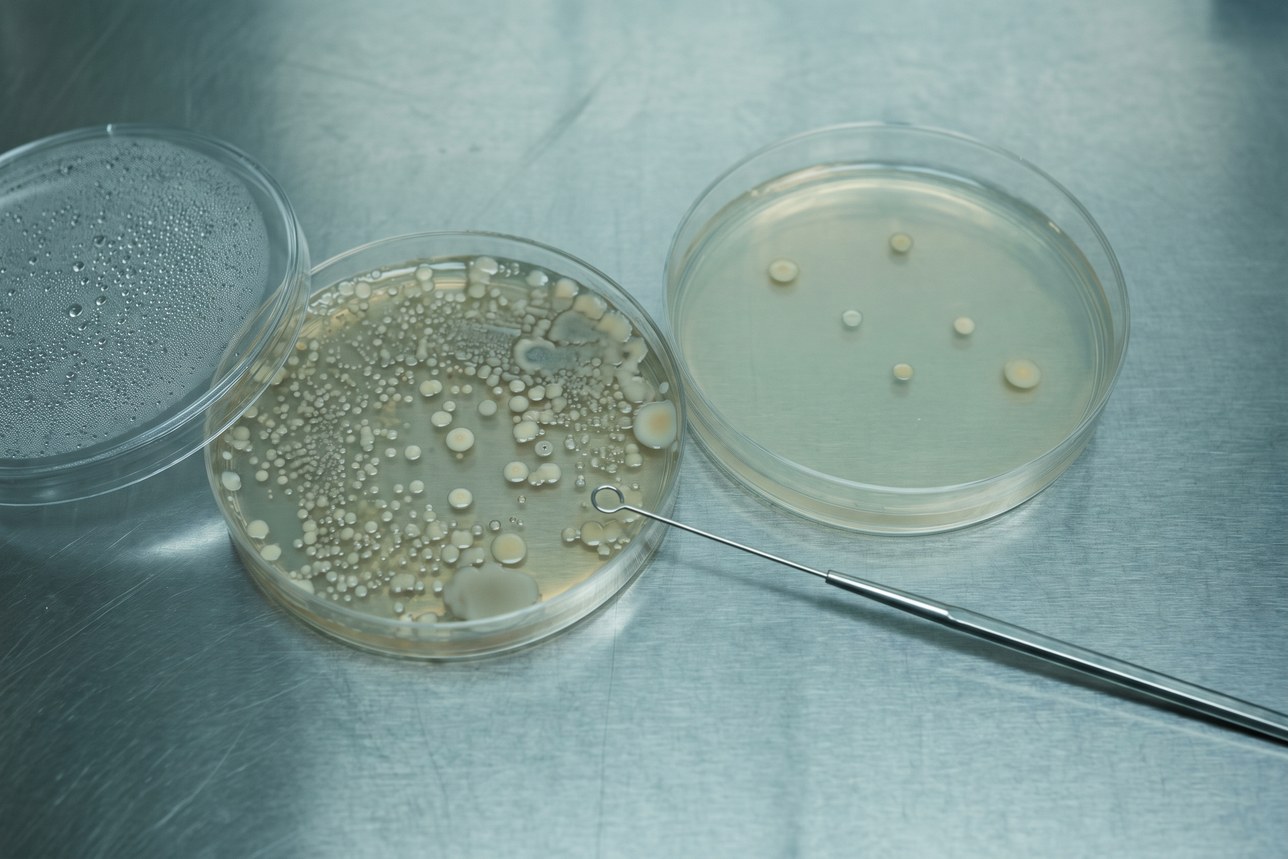 Oral probiotics for teeth and gums: a crowded plate of colonies beside an almost empty one