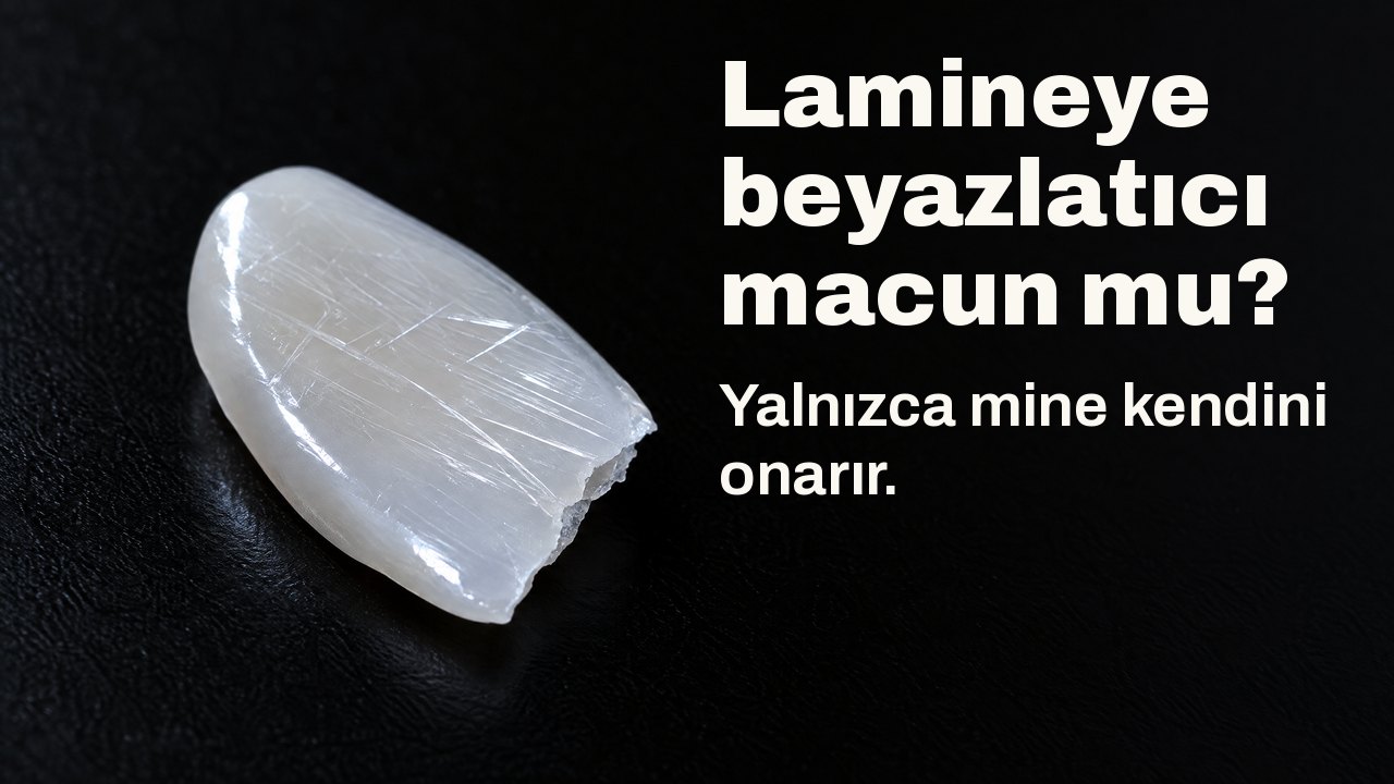 Lamineye beyazlatıcı macun mu? Yalnızca mine kendini onarır. Yalayan ışıkta: lamineyi andıran ince, parlak bir porselen parçası, yüzeyinde ince çizikler, siyah fonda.