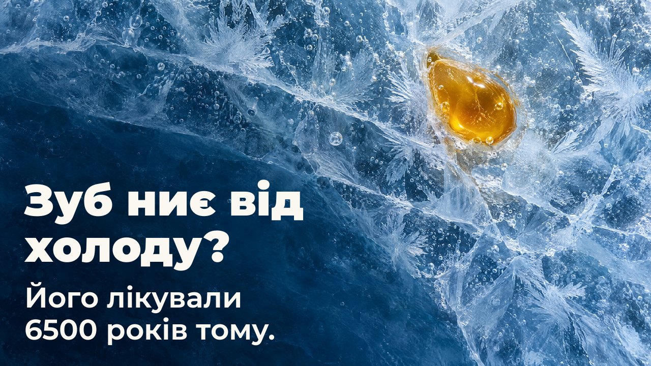 Зуб ниє від холоду? Його лікували 6500 років тому. Вигляд згори: крапля золотистого бджолиного воску, вмерзла в потрісканий блакитний лід із морозними візерунками та бульбашками повітря.