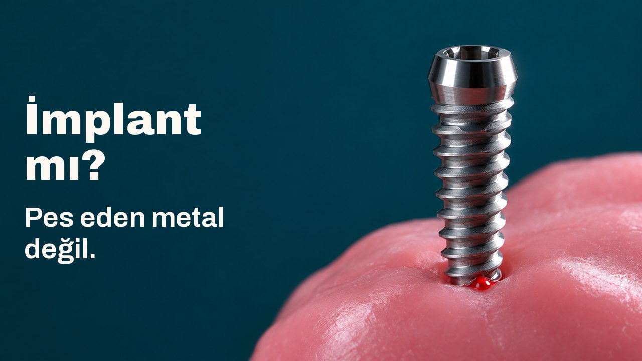 İmplant mı? Pes eden metal değil. Koyu camgöbeği bir arka plan önünde, yumuşak pembe bir mum yatağında dik duran cilalı bir titanyum vida; bir yandan sert ışık alıyor.