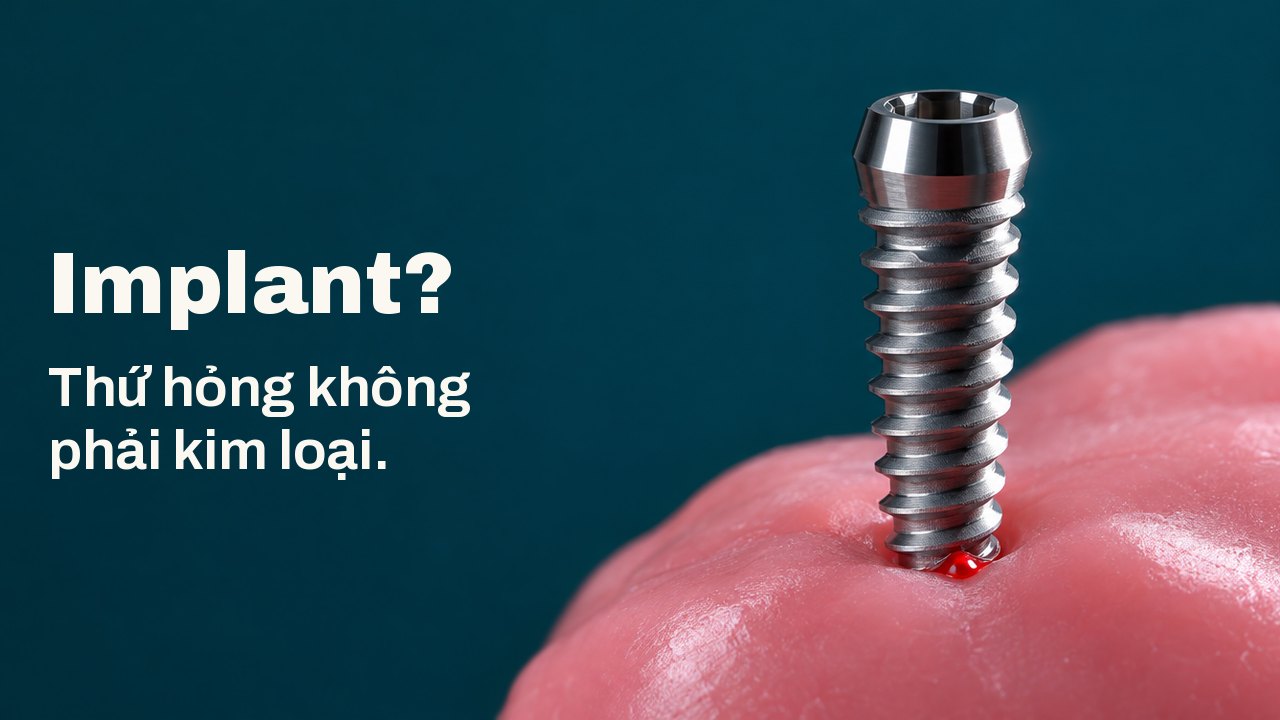 Implant? Thứ hỏng không phải kim loại. Một con vít titan bóng loáng đứng thẳng trên lớp sáp hồng mềm, được chiếu sáng gắt từ một bên trên nền xanh mòng két đậm.